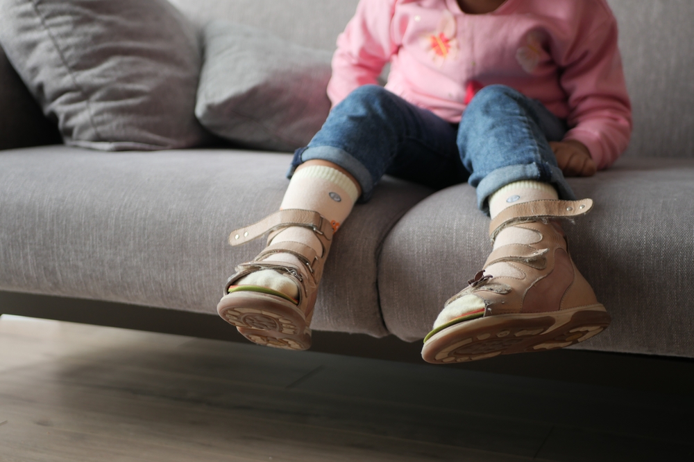 A young child's feet in braces, affected by cerebral palsy